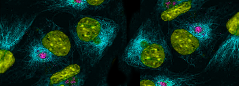 Polonia apela a la UE para recibir apoyo contra la peste porcina