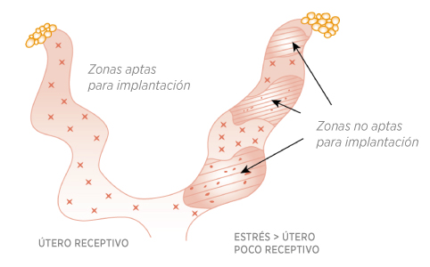 entorno uterino