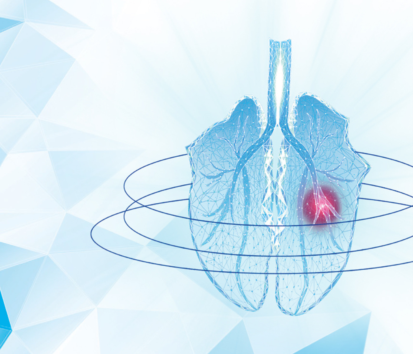 El papel de la Influenza en el complejo respiratorio de origen multifactorial