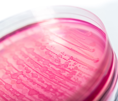 Patotipos de E. coli multirresistentes: enfoque en la cría intensiva de cerdos