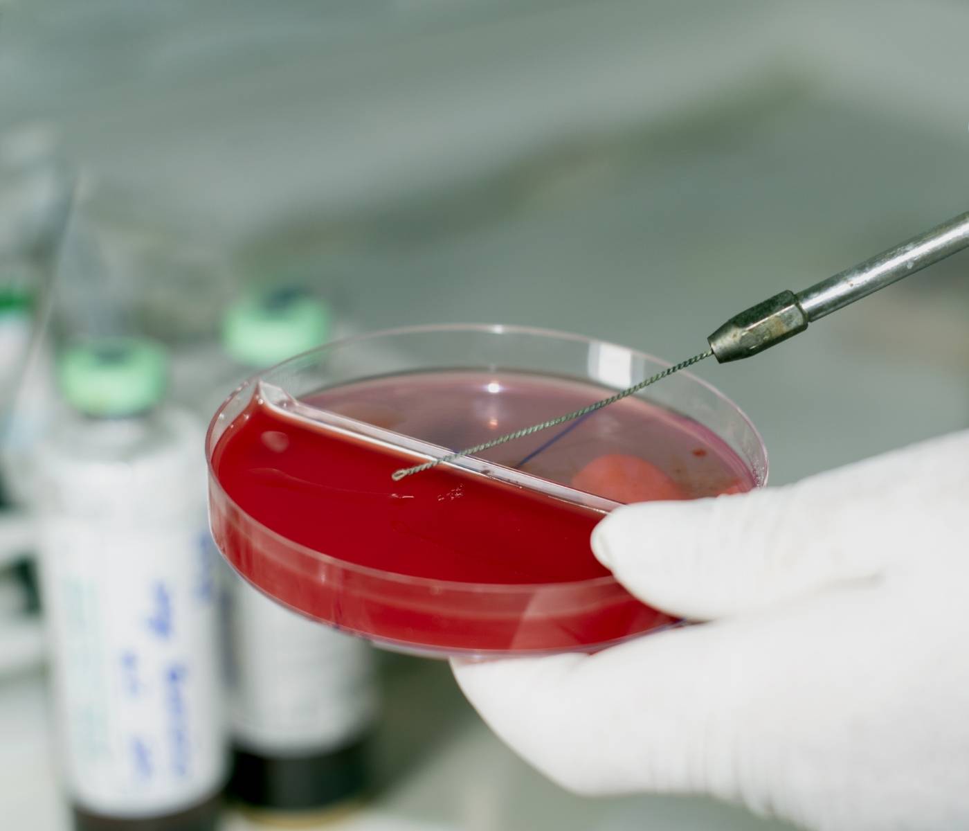 Antibiograma: importância da qualidade da amostra e diagnóstico laboratorial