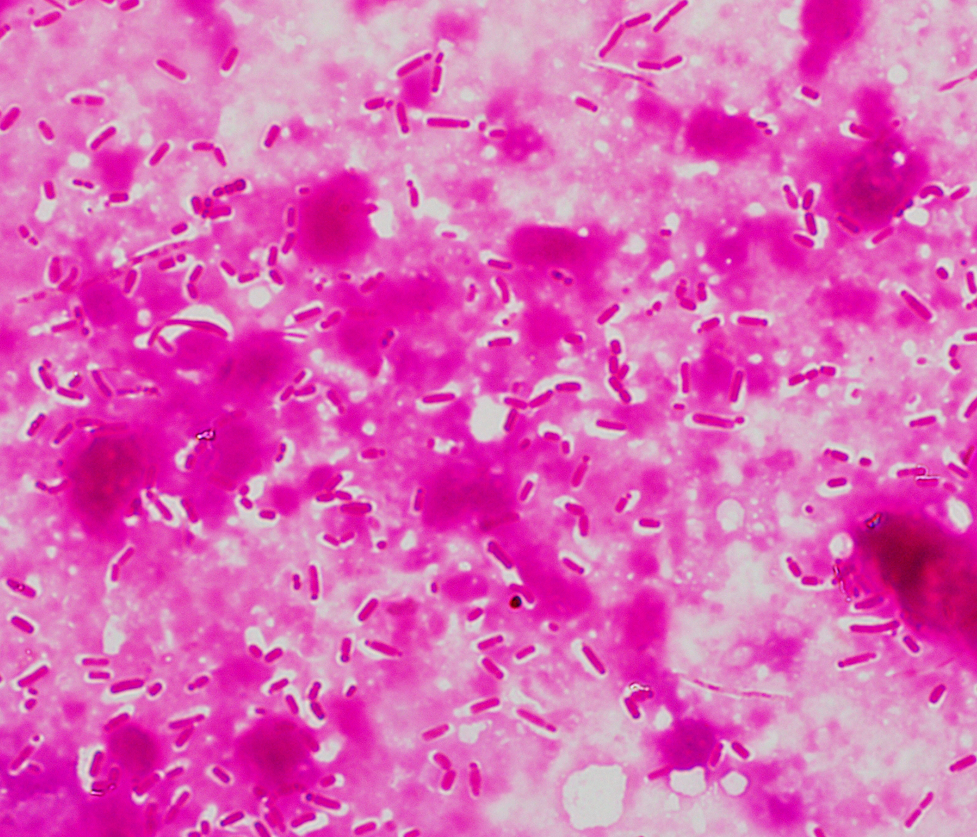 Clostridios en lechones  – Un poco de las principales enfermedades entéricas