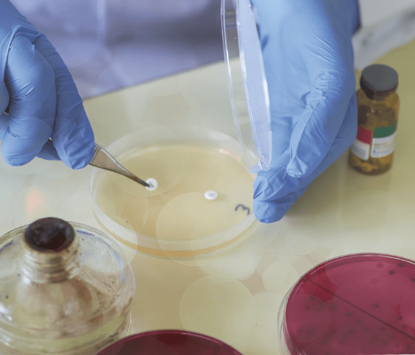 ¿Cómo se realiza una prueba de sensibilidad antibiótica en el laboratorio?