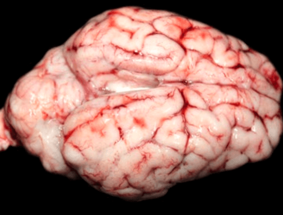 cerebro
