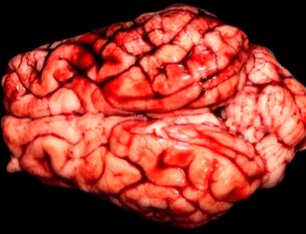 cerebro