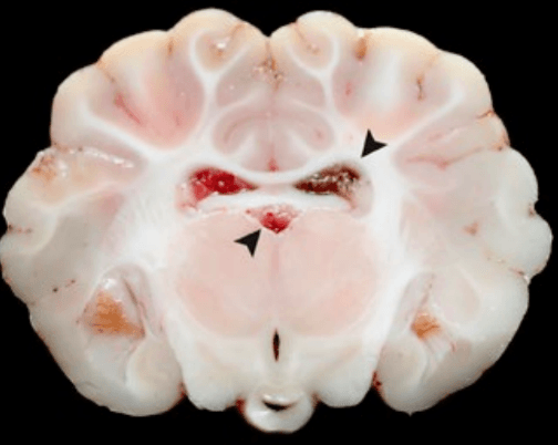 cerebro cerdo